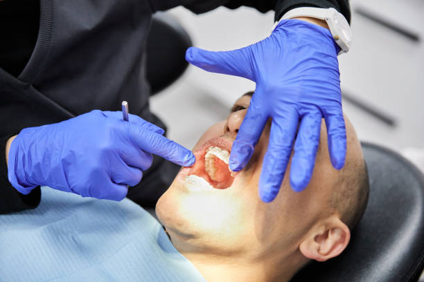 Best Emergency Dental Care for Broken or Chipped Teeth in Atlantic Highlands, NJ